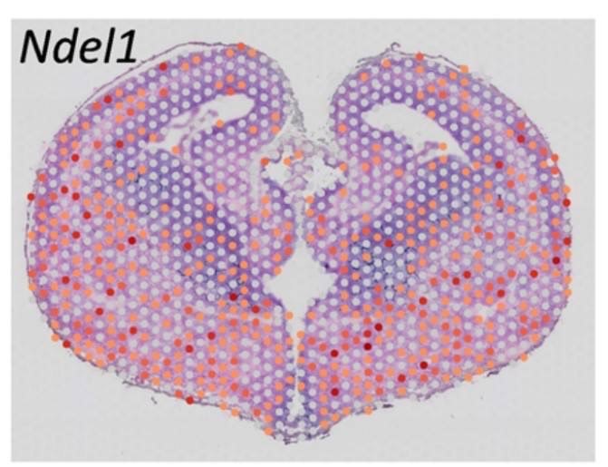 高雄長庚VS陽明交大研究團隊　再次發現「平腦症」致病新基因—NDEL1